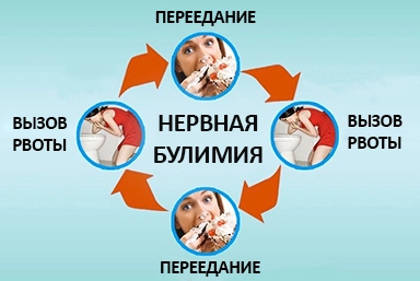 Лечение булимии в Алексине